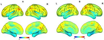 Alterations in whole-brain dynamic functional stability during memory tasks under dexmedetomidine sedation